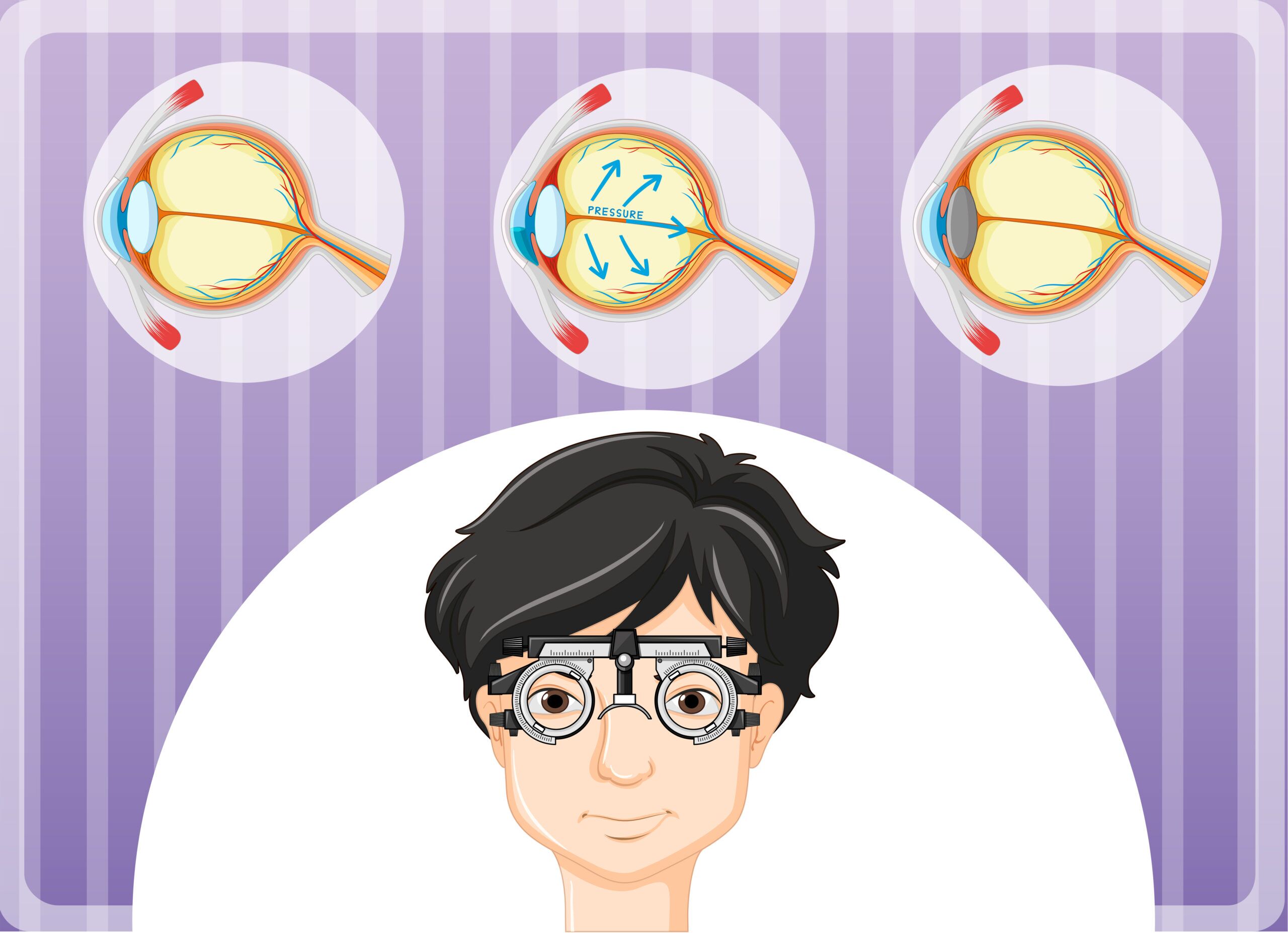 6 Symptoms of Cataracts
